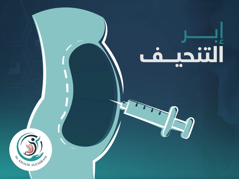 إبر التنحيف