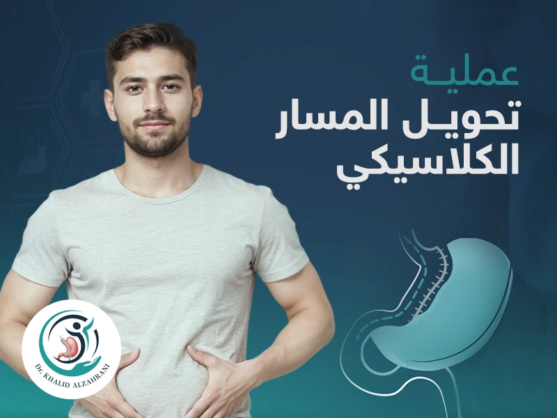 تحويل المسار الكلاسيكي
