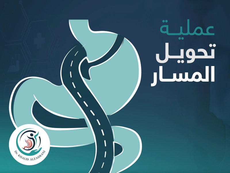 عملية تحويل المسار