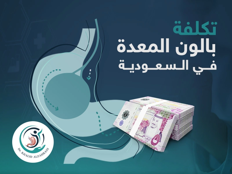 سعر بالون المعدة