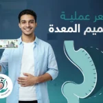 سعر عملية تكميم المعدة
