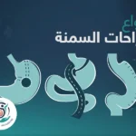 أنواع عمليات السمنة