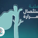 عملية استئصال المرارة