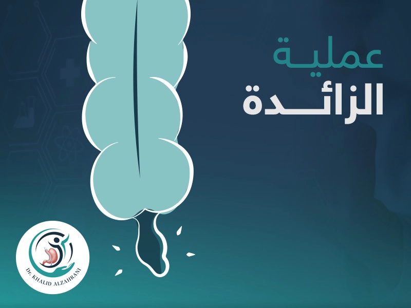 عملية الزائدة