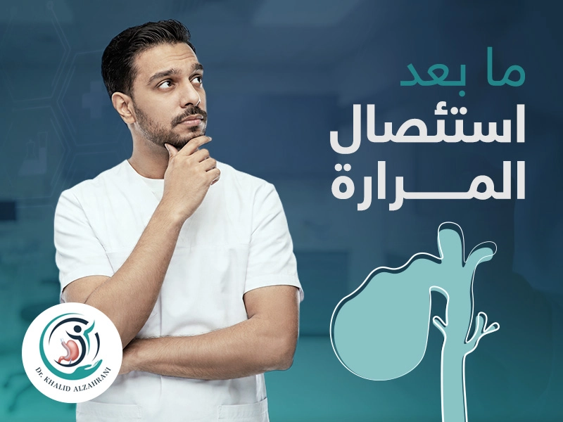 ما بعد استئصال المرارة