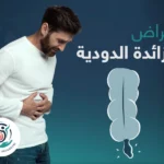أعراض الزائدة الدودية