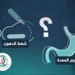 الفرق بين تكميم المعدة وشفط الدهون