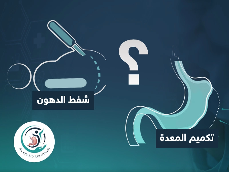 الفرق بين تكميم المعدة وشفط الدهون