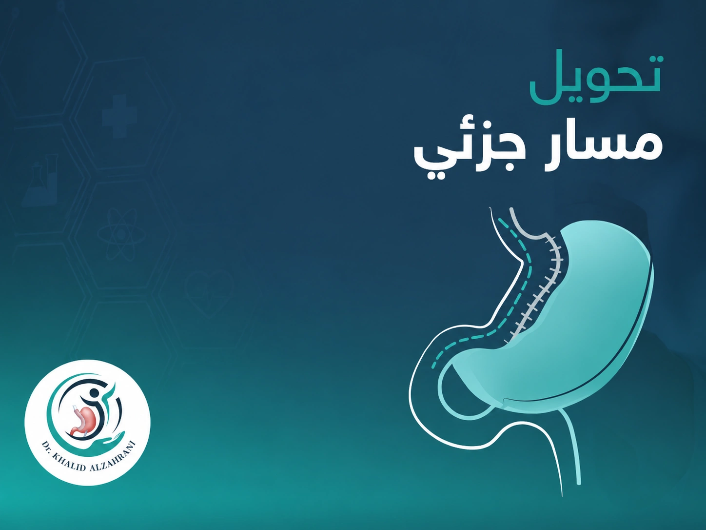 تحويل مسار جزئى