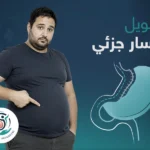 تحويل مسار جزئي