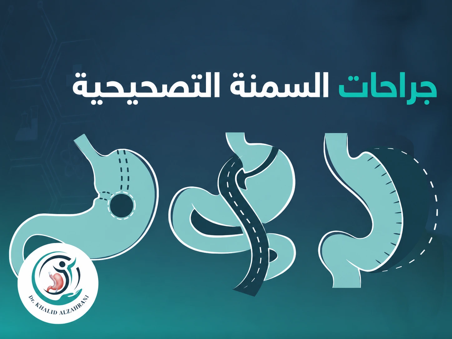 جراحات السمنة التصحيحية