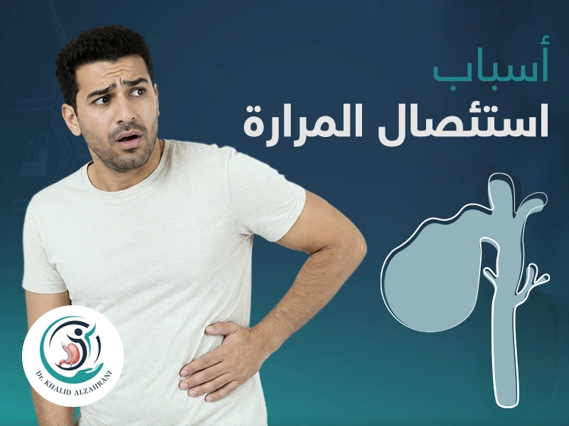 أسباب استئصال المرارة