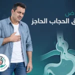 أعراض فتق الحجاب الحاجز