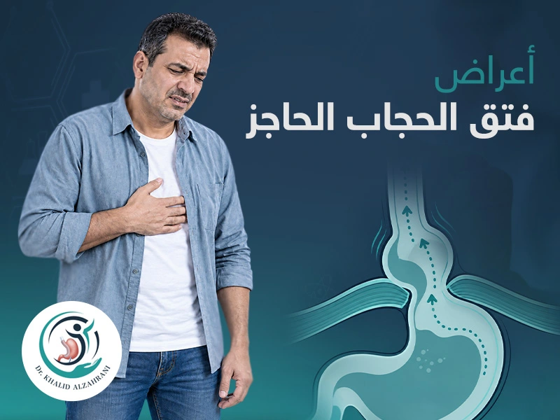 أعراض فتق الحجاب الحاجز