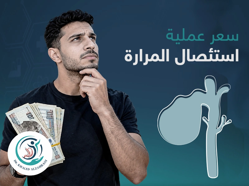 سعر عملية استئصال المرارة
