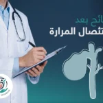 نصائح بعد استئصال المرارة