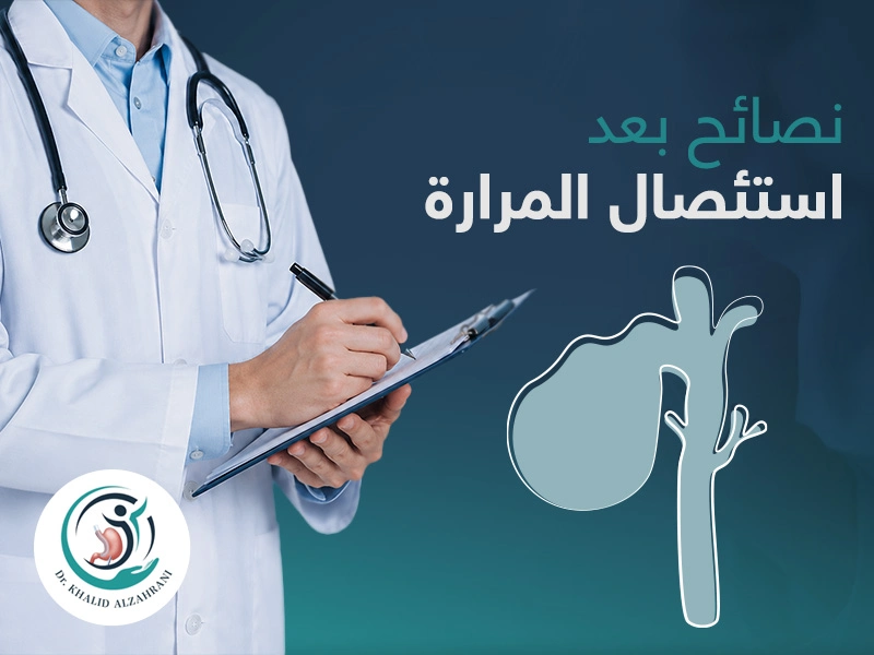 نصائح بعد استئصال المرارة